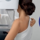 Mi a különbség a mammográfia és az emlő tomoszintézis között?