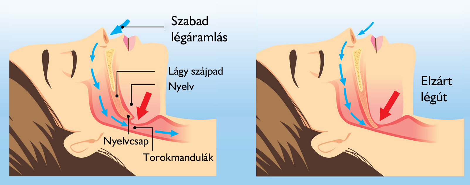 A horkolás anatómiája